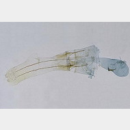 Klimeschiopsis kiningerella w